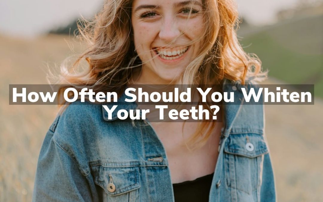 How Often Should You Whiten Your Teeth?