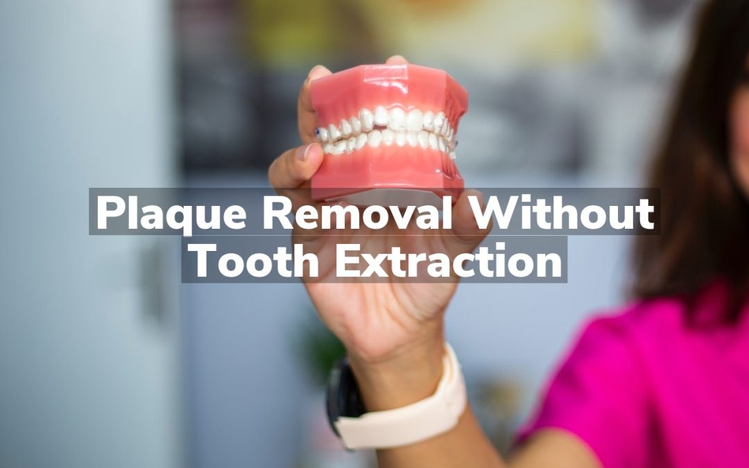 Plaque Removal Without Tooth Extraction