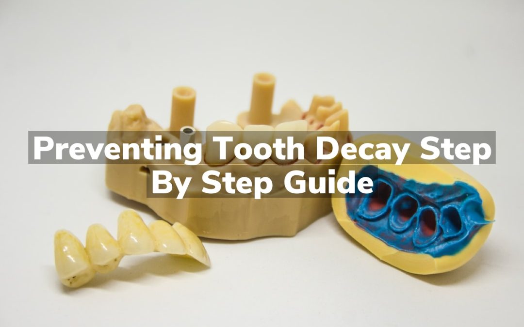 Preventing Tooth Decay Step by Step Guide