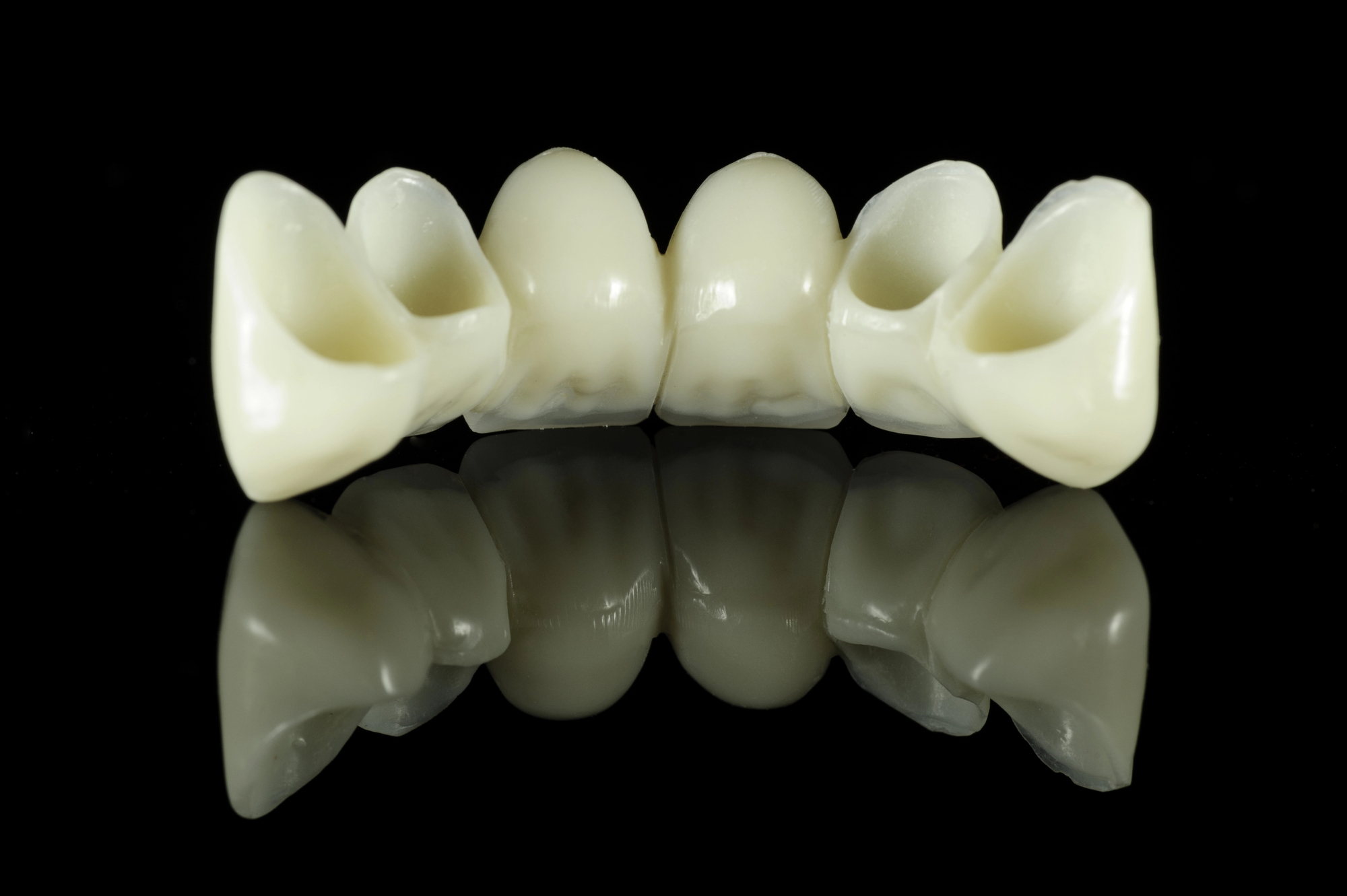 Teeth on One Dental Bridge: How Many?